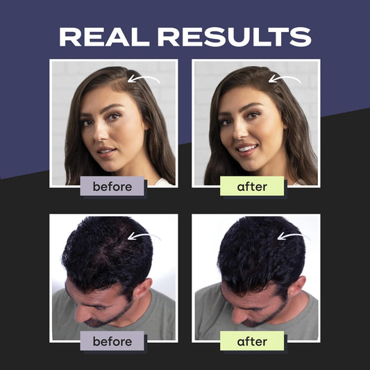 Toppik Hair Building Fibers with Premium Keratin Fibers Conceals Hair Thinning and Hair Loss for Fuller, Black
